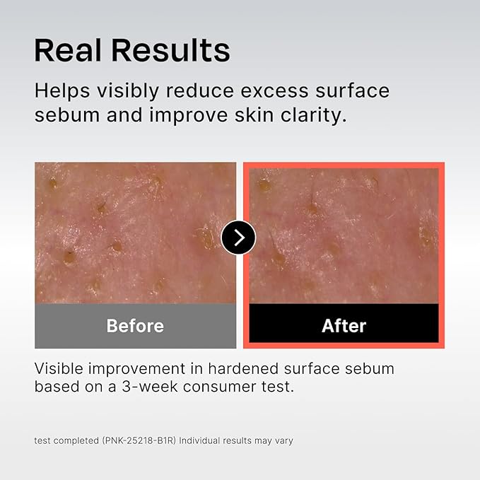Sebum Rebalancing Rx 131 Ampoule | Pore Clearing Serum | Tighten Enlarged Pores | Repair Skin Barrier | Rapid Soothing for Daily Use | Oily & Combination Skin| 1.01 Fl Oz