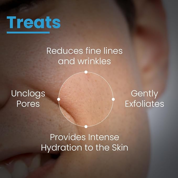 FCL Penta peel pads| Exfoliant | Removes dead cells | Reduces fine lines & wrinkles | Gentle & safe peeling pads| Improves skin texture | Shrinks open pores | Paraben Free | 25 pads