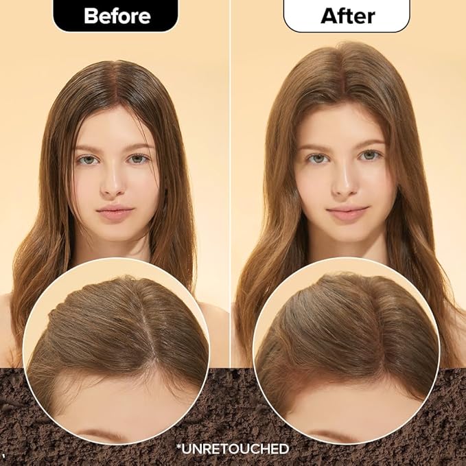 I DEW CARE Tap Secret Dry Shampoo Powder with Biotin - Tap Secret Medium Brown | Strengthening & Volumizing, Powder Type, Refillable, Travel size, Non-aerosol, Brunette, Korean Ginseng, 0.24 Oz