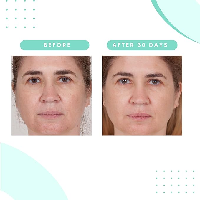 Serious Skincare - Glycolic Acid Resurfacing Face Pads for Smoother Skin - Exfoliates Dead Skin Cells - Pre-Soaked Cotton Disc - Vitamin E, ALoe -2 Pack (60 Pads Each)