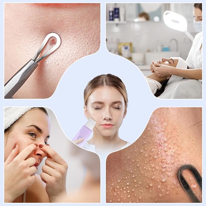 Skin Scrubber Face Spatula Skin Spatula Pore Cleaner Blackhead Remover Tools for Facial Deep Cleansing Skin Care Tool for Men and Women (Purple)