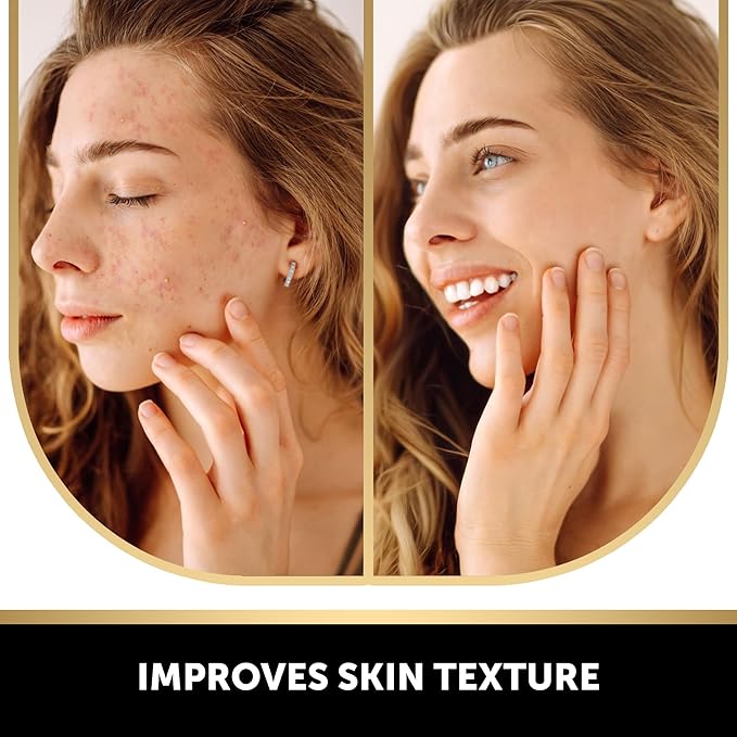 VALITIC Kojic Acid Vitamin C and Retinol Soap Bars with Turmeric for Dark Spot - Original Japanese Complex Infused with Collagen, Hyaluronic Acid, and Vitamin E (4 Pack)
