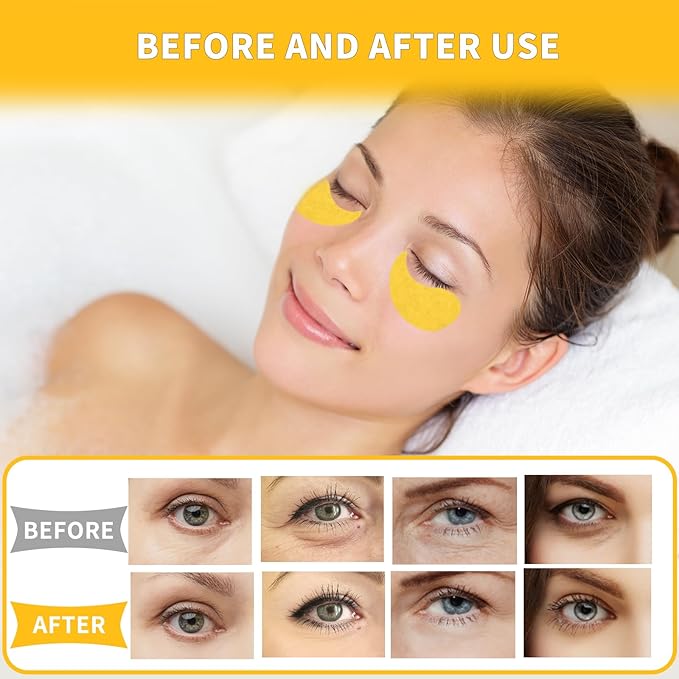 Under Eye Patches 70PCS, 24K Gold Eye Patches for Puffy Eyes Treatment, Under Eye Masks for Dark Circles and Puffiness, Non-Irritating Eye Mask Skincare, Eyes Bags Treatment, Eye Gel Pads