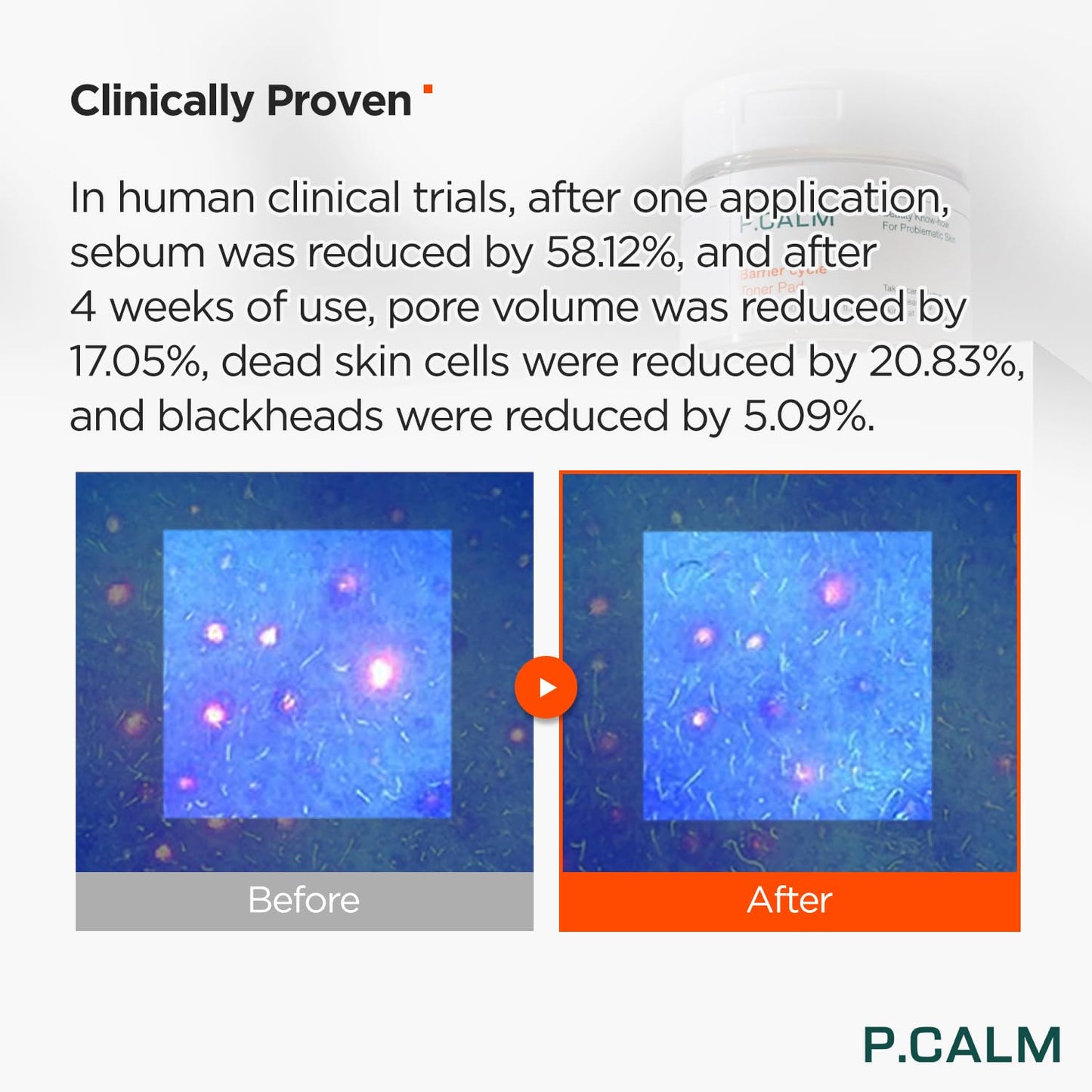 P.CALM Barrier Cycle Toner Pad β 60 Pads with Centella Asiatica & Papaya Extract for Soothing, Moisturizing & Exfoliating, Korean Vegan Facial Toners Pads for Sensitive Skin (160ml / 5.41 fl.oz)