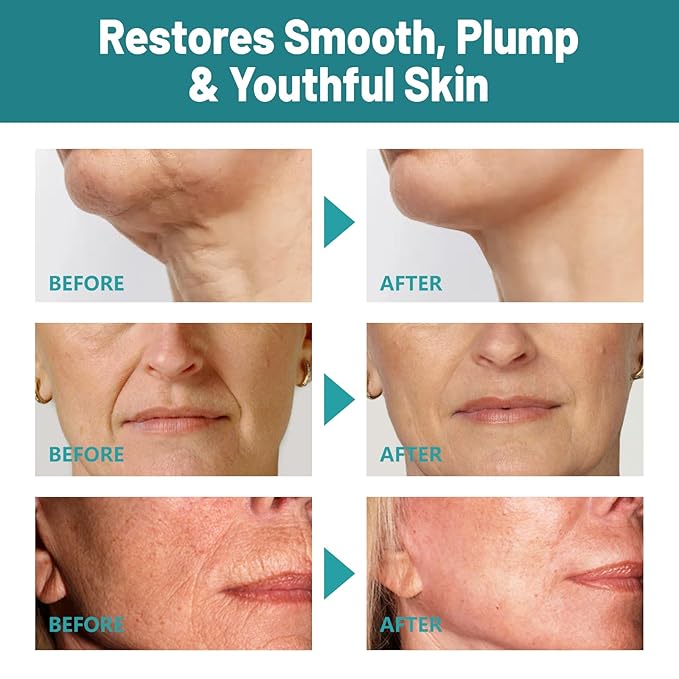 Crepes skin cream for aging skin ,Crepes Skin Repair Treatment, Firming Cream with Hyaluronic Acid & Shea Butter to Deeply Moisturize & Tighten Wrinkly Dry