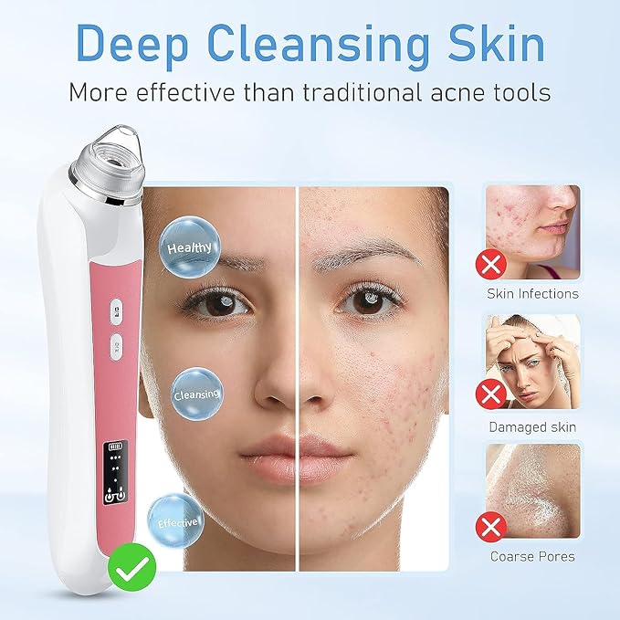 Blackhead Remover Vacuum, USB Interface Type Pore Vacuum, Black Head Extractions Tool with Camerafor, Men and Women Pore Cleaner, 3 Adjustment Modes & 6 Suction Heads(Light Pink)