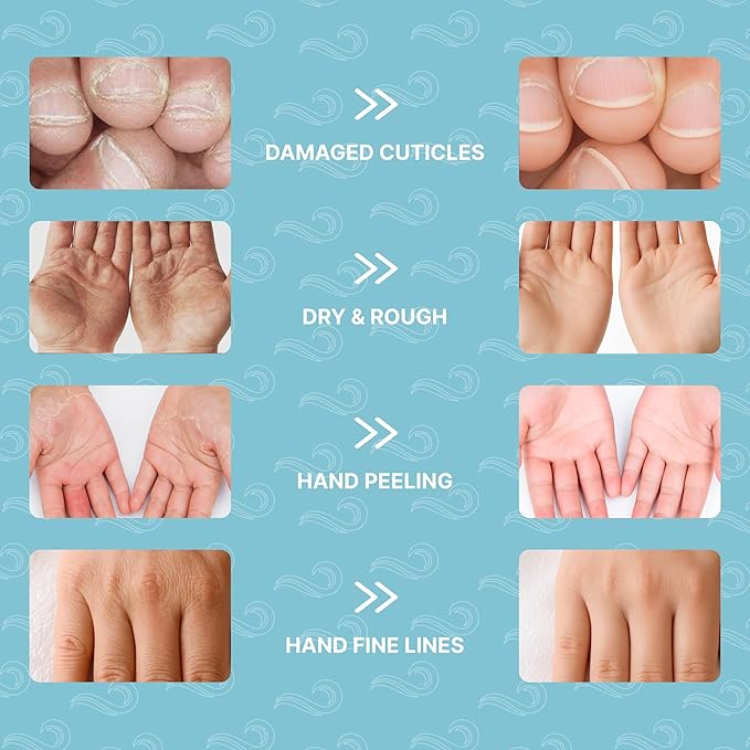 Hand Mask Moisturizing Gloves for Dry Cracked Skin | Hydrating Treatment with Snail Mucin Shea Butter Hyaluronic Acid Bisacolol Vitamin E | Softening Exfoliator for Hands, Repair Glove Mask | 6 Pairs
