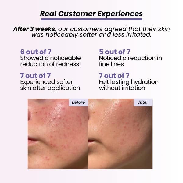 Moonlight Recovery Hydrating Night Cream for Sensitive Skin | Soothing Face Moisturizer for Redness, Dryness & Irritation | Fragrance-Free, Non-Comedogenic, Barrier-Repair