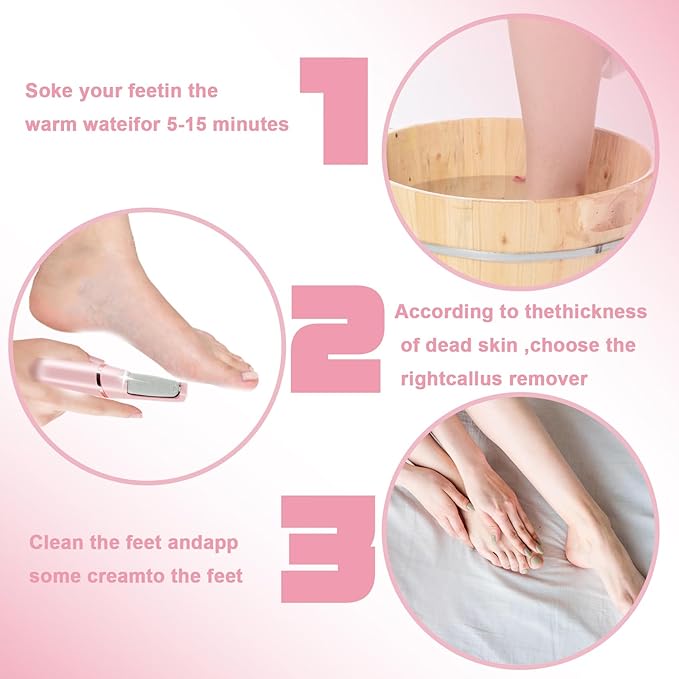 Smooth Pedicure Wand for Feet Electric Foot Callus Remover Rechargeable Pedicure Tools for Feet Callus Removal Tool Rechargeable Foot Callus Remover Best Device for Feet Care Freely