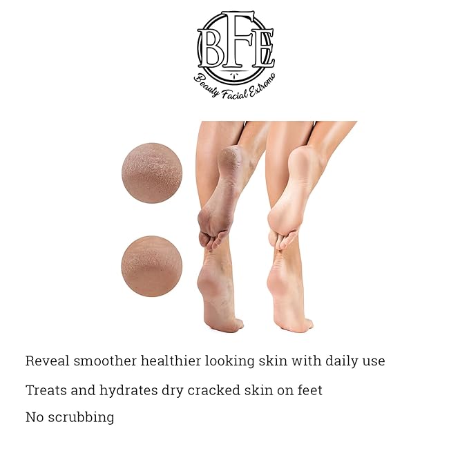 Keratosis Pilaris Exfoliating Body Lotion– 12% Lactic Acid. Provides Immediate Moisture & Gentle Exfoliation to Treat symptoms Associated with Keratosis Pilaris & Dry, Bumpy Skin Conditions.