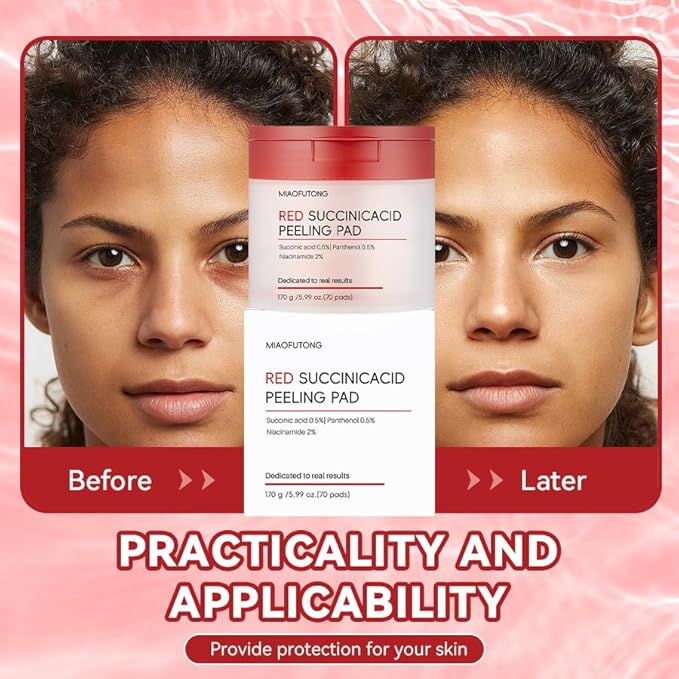 Facial Peeling Pads with Succinic Acid, Niacinamide, AHA, BHA, Panthenol for Breakout-Prone Skin, Red (70p, Succinic Acid)