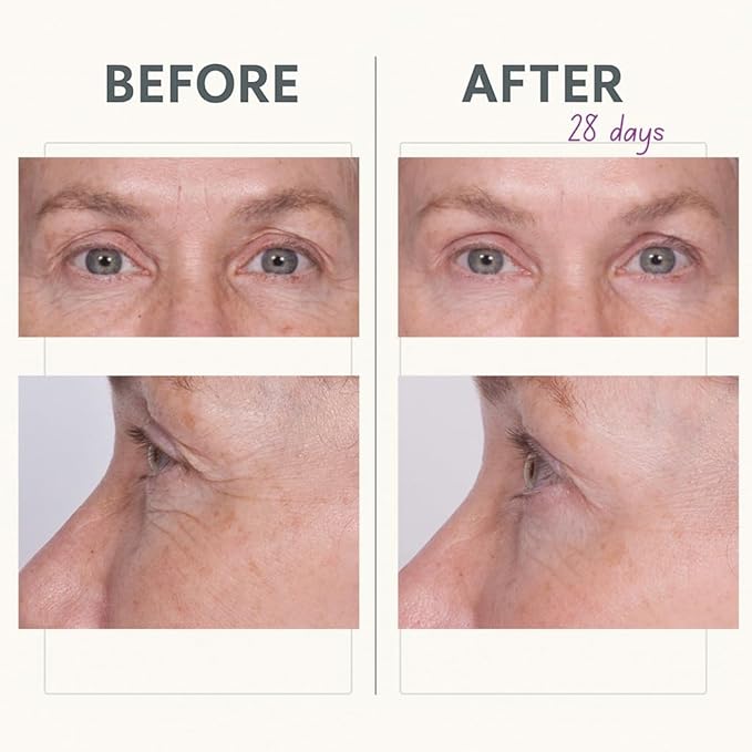 Serious Skincare - Reverse Lift Tightening Eye Cream with Peptides - Hydrating Anti-Aging Eye Cream -Temporarily Lift & Firm Eye Lids and Brow - Skin Firming Wrinkle Formula - Women, Men - 1 Fl. Oz.