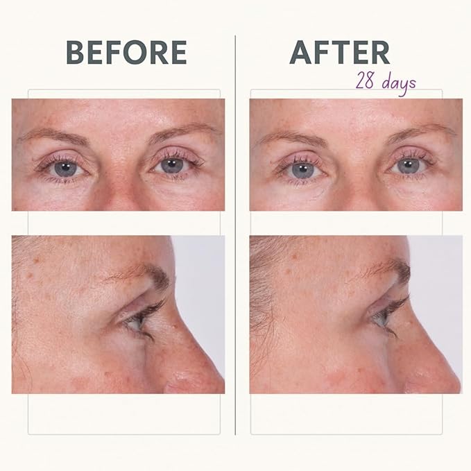Serious Skincare - Reverse Lift Tightening Eye Cream with Peptides - Hydrating Anti-Aging Eye Cream -Temporarily Lift & Firm Eye Lids and Brow - Skin Firming Wrinkle Formula - Women, Men - 1 Fl. Oz.