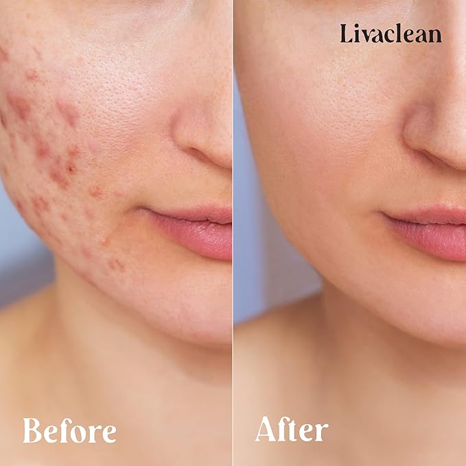 LivaClean 60 CT 20% Glycolic Acid Peel Pads with Aloe Vera – Resurfacing Toner Pads for Face, Exfoliating Wipes for Fine Lines, Wrinkles, Large Pores, Textured Skin, Includes Tweezer
