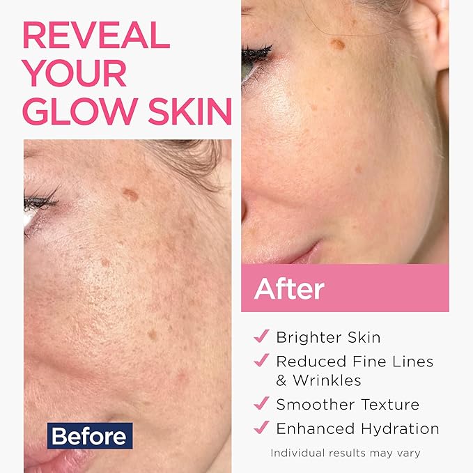 Retinol Serum for Face with Hyaluronic Acid, Vitamin E & Aloe Vera Anti-Aging Serum - All Skin Types - Supports Even Tone - Day and Night - Made in USA - 1 Oz