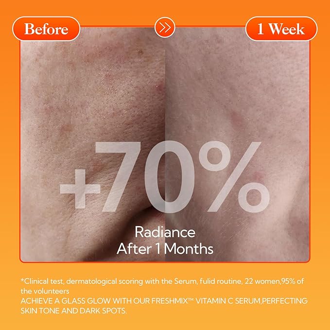 LANBENA Non-Oxidizing Vitamin C Serum 10%: Niacinamide Serum + Freeze-Dried Tablets, Brightening Anti-Aging Essence for Sensitive Skin, Non-Greasy, Reduces Dark Spots & Wrinkles (30 Tabs/1.05 Oz)