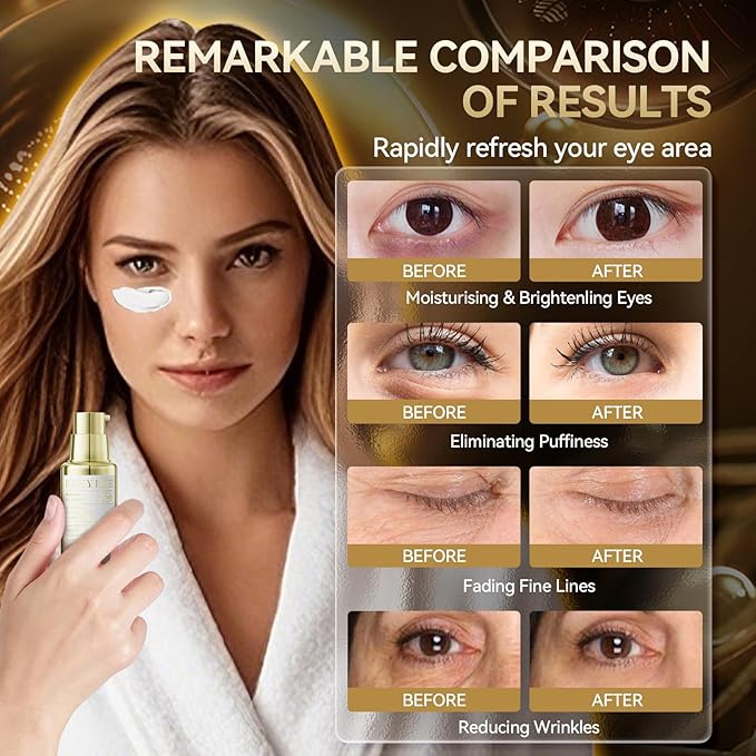 BREYLEE Renewal Care Kit with Aloe Vera Eye Masks – 60 Pcs & Renewing Serum, Under Eye Patches For Puffy Eyes,Hydrates, Improves And Firms The Eye Area, Suitable For Both Women And Men