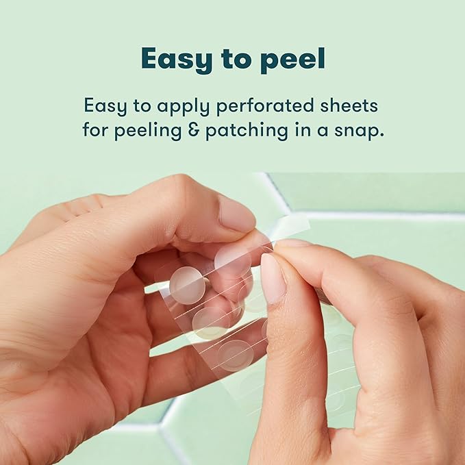 Proactiv Zits Happen® Hydrocolloid Acne Patches- Pimple Patches for Face and Back Acne with Pore Cleansing Salicylic Acid- 30 Count