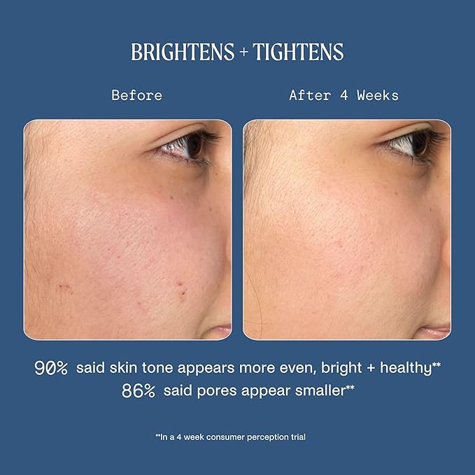 Kinship Dream Wave 2% Bio-Retinoid Overnight Ultra Hydrating Serum for Face | Retinol for Sensitive Skin | Anti Aging Niacinamide + Tranexamic Acid | Smooth Wrinkles | Redness Reducing Skin Care 1 Oz