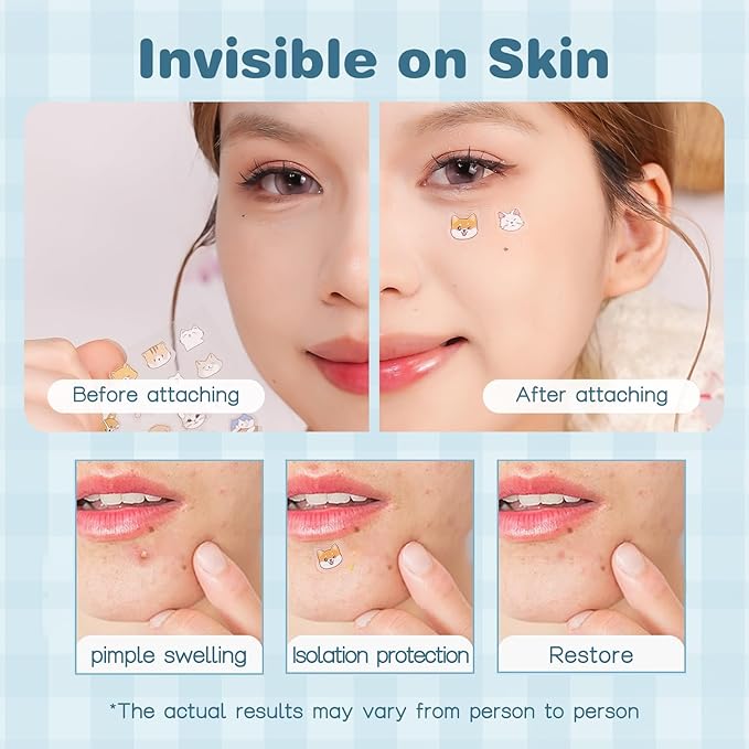 Venrock Pimple Patch, 48 Hydrocolloid Patches with Tea Tree Oil, 24 Cute Animal Shapes, Salicylic Acid Acne Treatment