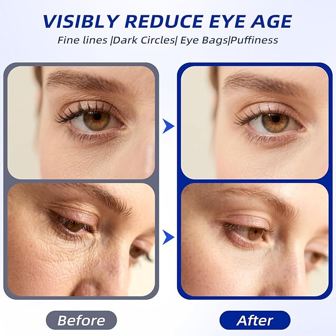 Eye Cream for Wrinkles & Crows Feet - with Essential Ceramides, Peptides & Caffeine & Niacinamide - Reduce Puffiness & Bags Under Eyes, Under Eye Cream for Women & Men, 0.5 Oz