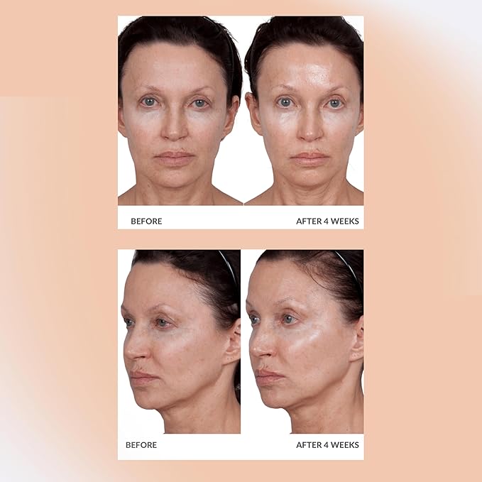 Consult Beaute Volumagen - Collagen Anti-Aging Serum for the Face - Hyaluronic Acid - Skin Nourishing & Plumping - Hydrates and Temporarily Fills for Smoother, Bouncy Skin - 2 Oz. Duo (2 Piece Set)