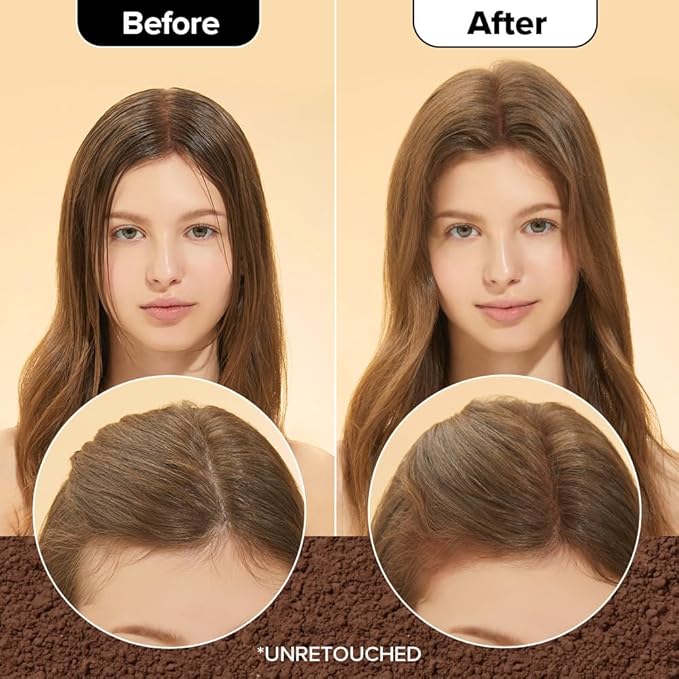 I DEW CARE Biotin Clarifying Dry Shampoo - Tap Secret Brown | Strengthening & Volumizing, Powder Type, Refillable, Travel size, Non-aerosol, Brunette, Korean Ginseng, Easter Basket, 0.24 Oz