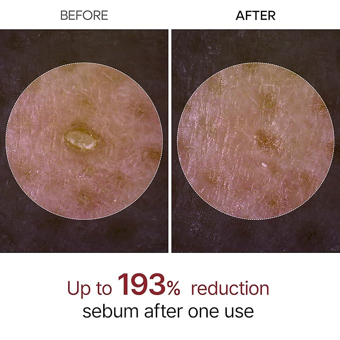 Peel Shot Glow Rice Peeling Ampoule, Soft Exfoliating Face and Body Scrub Dead Skin Cells Remover for All Skin Types korean skin care 80ml (BLACK RICE)