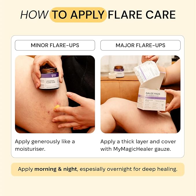 Universal Flare Care | Drawing Salve for HS, Boils, Cysts, Hemorrhoids, Pilonidal Cyst, Abscess | Anti-Chafing, Wound Care, Relief for Itching Skin w/Propolis & Egg Yolk Extract 4 oz