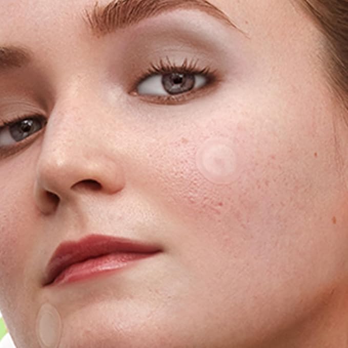 PEACE OUT Microneedling Dark Spot Brightening Dots