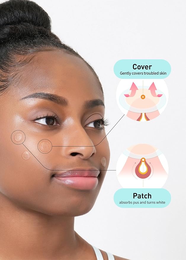 OLIVE YOUNG Care Plus Spot Patch | Hydrocolloid Acne Korean Spot Patch to Cover Zits, Pimples and Blemishes, for Troubled Skin and Face (Hydrocolloid, 15 Count (Pack of 1))