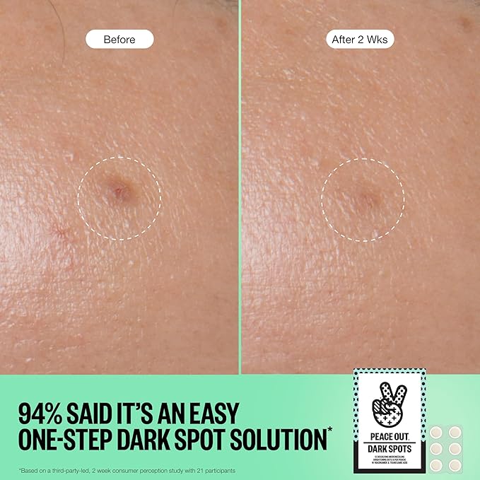 PEACE OUT Microneedling Dark Spot Brightening Dots