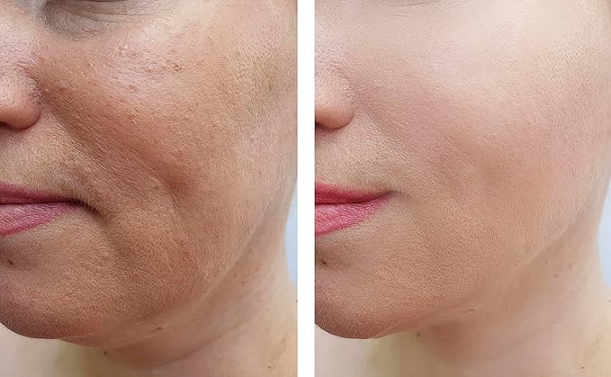 Vitality Precision Skin Retinol Peel Pads .5%- 3 month supply