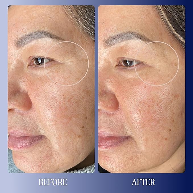 Kinship Dream Wave 2% Bio-Retinoid Overnight Ultra Hydrating Serum for Face | Retinol for Sensitive Skin | Anti Aging Niacinamide + Tranexamic Acid | Smooth Wrinkles | Redness Reducing Skin Care 1 Oz