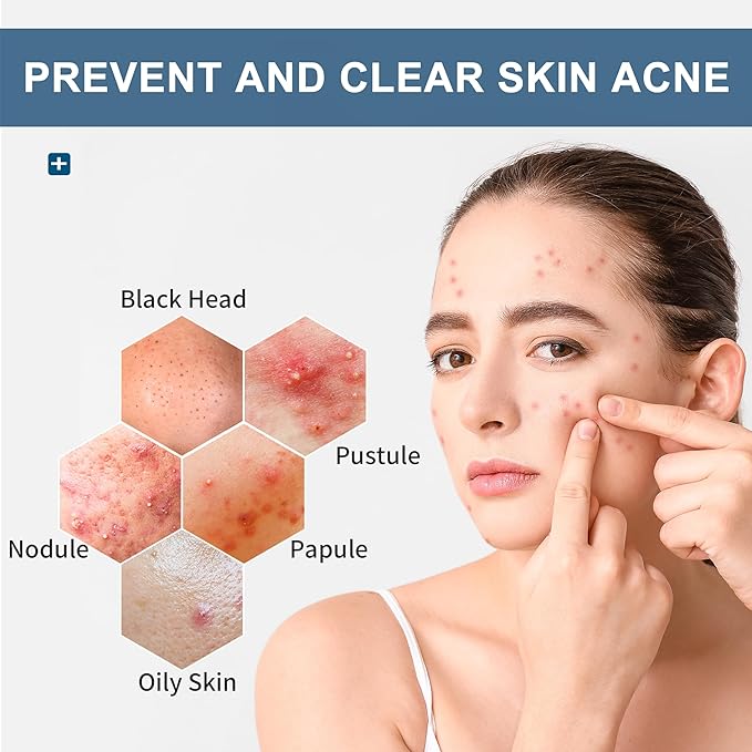 Acne Wipes for Face & Back, Acne Treatment Wipes with Salicylic Acid, Acne Scars and Dark Spot Remover with Natural Essential Oil for Face, Body, Back, and Butt