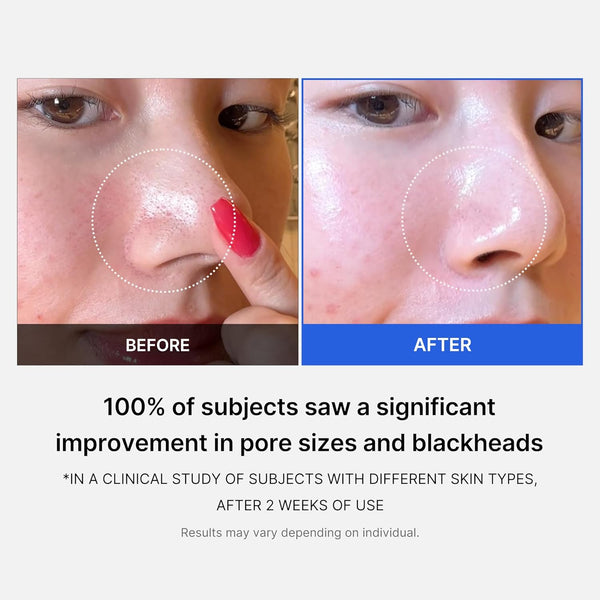 Smooth Skin Pore Pads